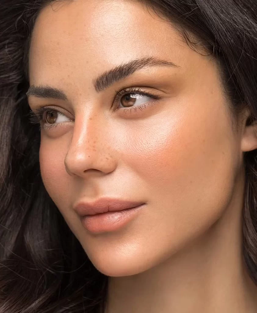 Tijuana Rhinoplasty Surgeon Dr. Illich Navarro is a Facial Plastic Surgeon known for delivering natural-looking rhinoplasty results.